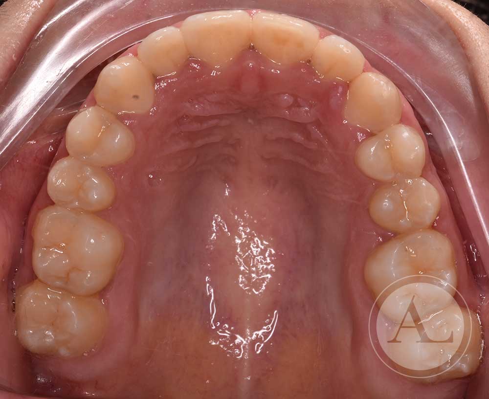 Ortodoncia Clínica dental Antonio Lucena