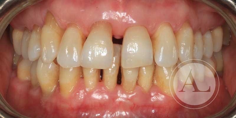 Mejora salud dental Antonio Lucena