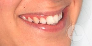 Tratamiento dental clínica Antonio Lucena