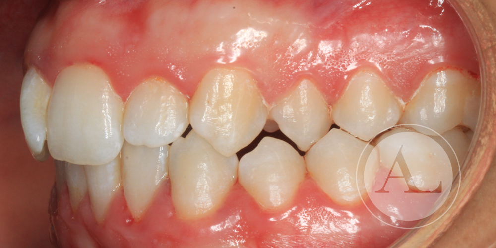Tratamiento de ortodoncia Antonio Lucena