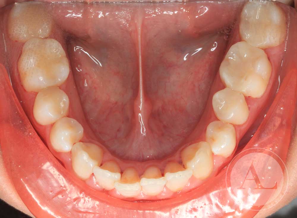 Corrección dental