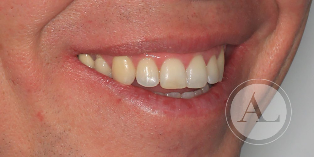 Ortodoncia en Clínica Dental Antonio Lucena