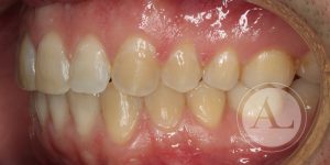 Ortodoncia Clínica Dental Antonio Lucena