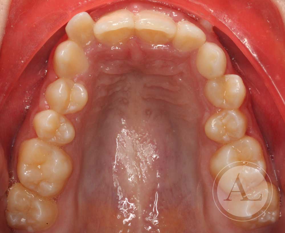 Ortodoncia Clínica dental Antonio Lucena
