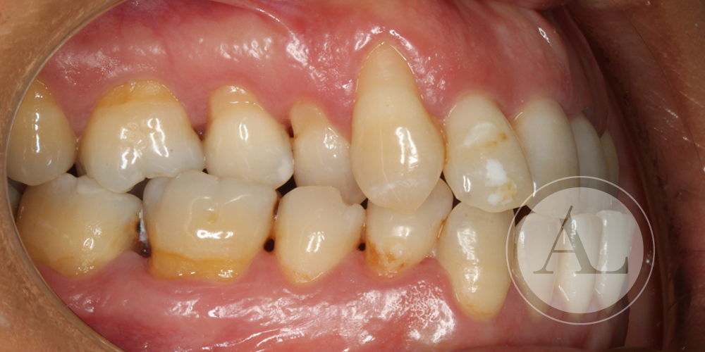 Tratamiento periodontal Clínica Dental Córdoba