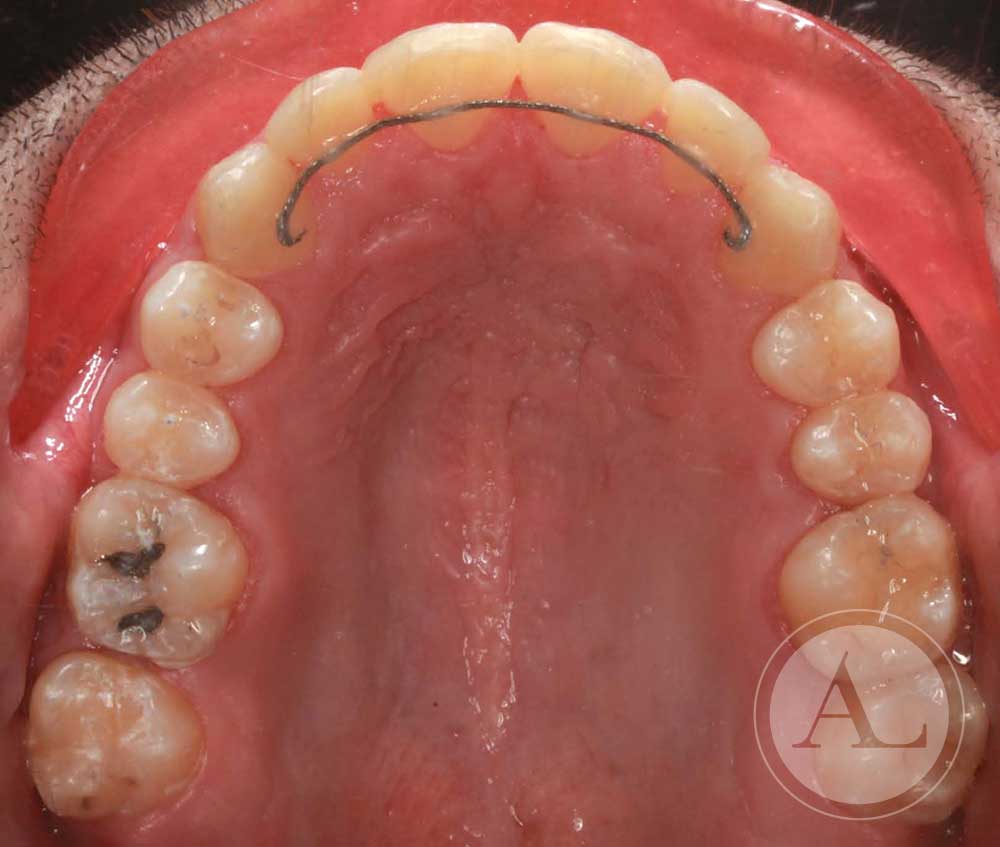 Análisis final ortodoncia