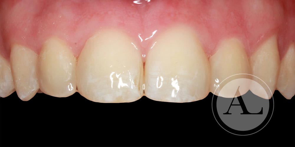 microestética dental Ortodoncia