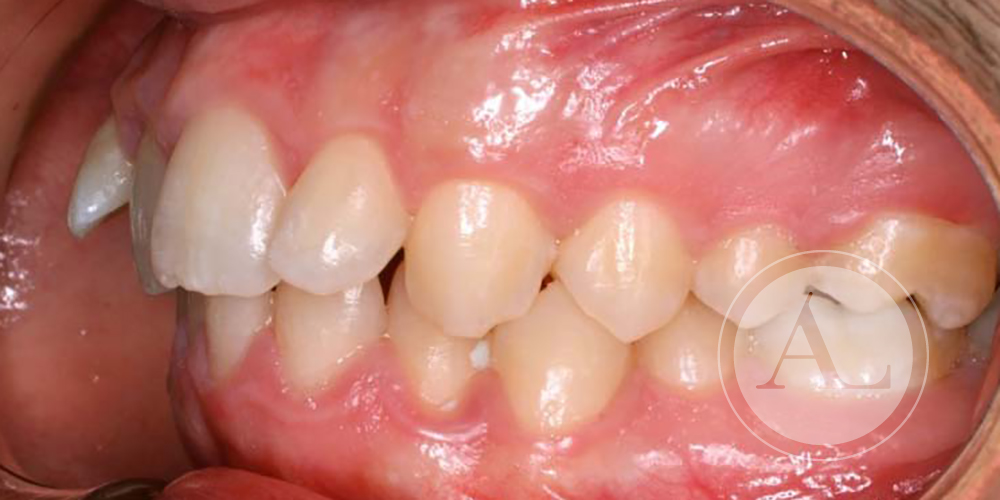 Tratamiento de ortodoncia Clínica Dental Antonio Lucena