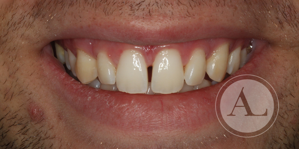 Ortodoncia en Clínica dental Antonio Lucena