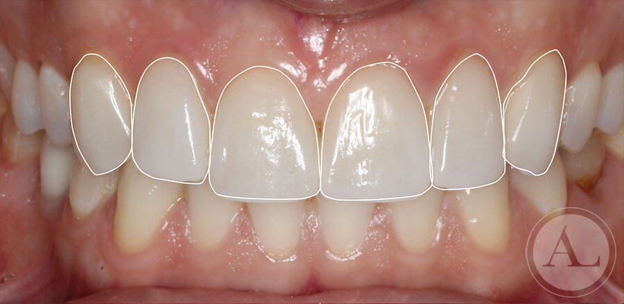 estetica-dental-4-3