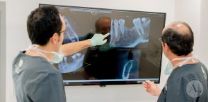 implantes-dentales-clinica-lucena