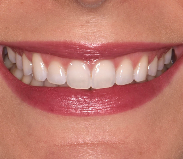 Estética dental en Córdoba